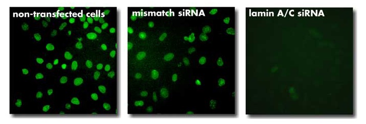 INTERFERin - Gene silencing