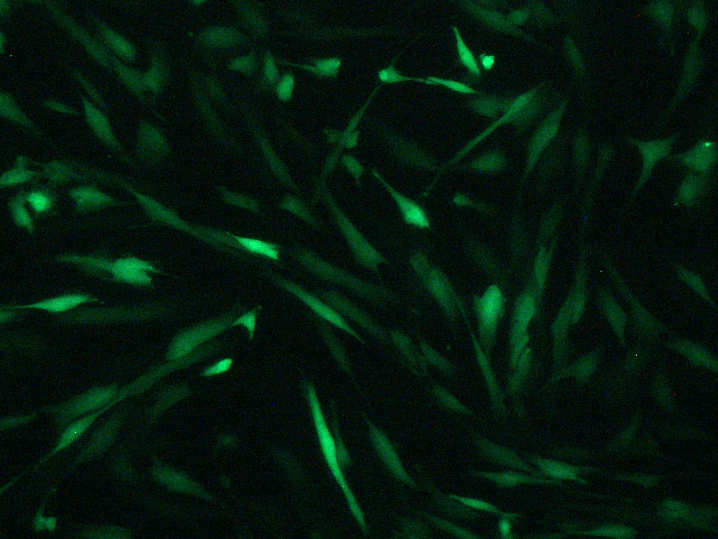 jetMESSENGER - Fibroblast fluorescence