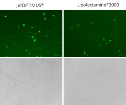 Transfection of primary rat cortical neurons using jetOPTIMUS® vs Lipofectamine® 2000